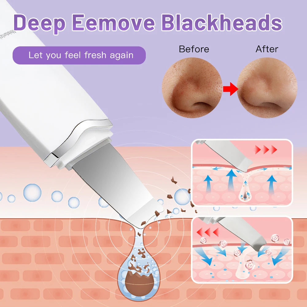 Cleansing Ultrasonic Skin Care