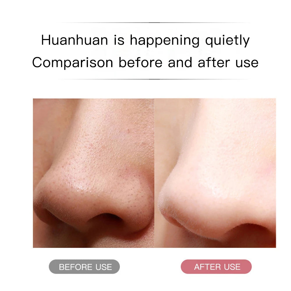 Cleansing Ultrasonic Skin Care